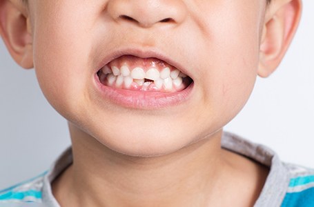 a child showing their teeth