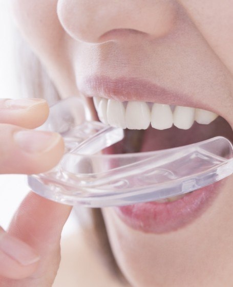 Closeup of dental patient placing protective nightguard