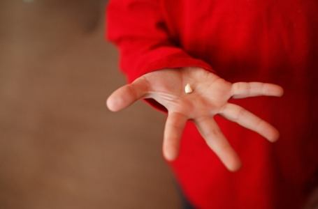 Child holding tooth removed under general anesthesiology