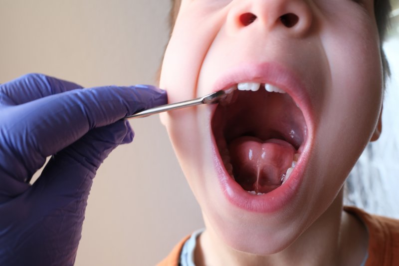 a child with tongue-tie visiting their dentist
